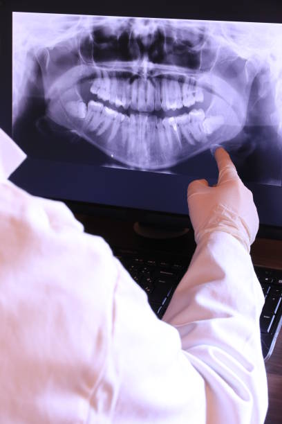 Best Emergency Dental Surgery in Dupont, WA