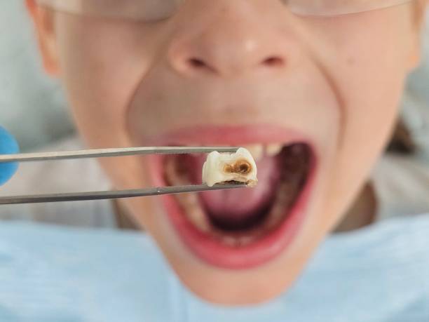 Best Pediatric Emergency Dentist in Dupont, WA